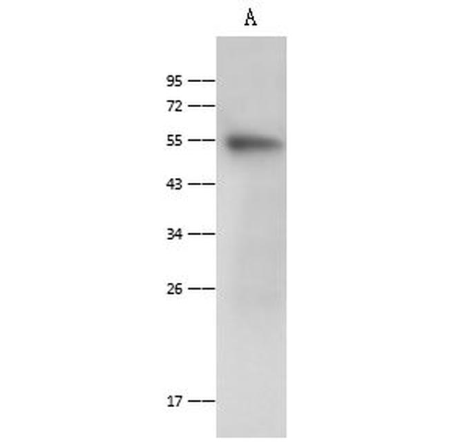 FUT10 Antibody in Western Blot (WB)