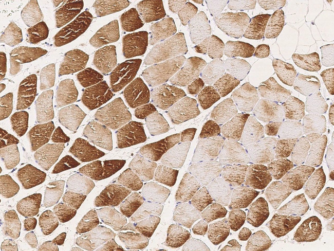 SLK Antibody in Immunohistochemistry (Paraffin) (IHC (P))