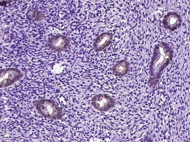 GGCT Antibody in Immunohistochemistry (Paraffin) (IHC (P))