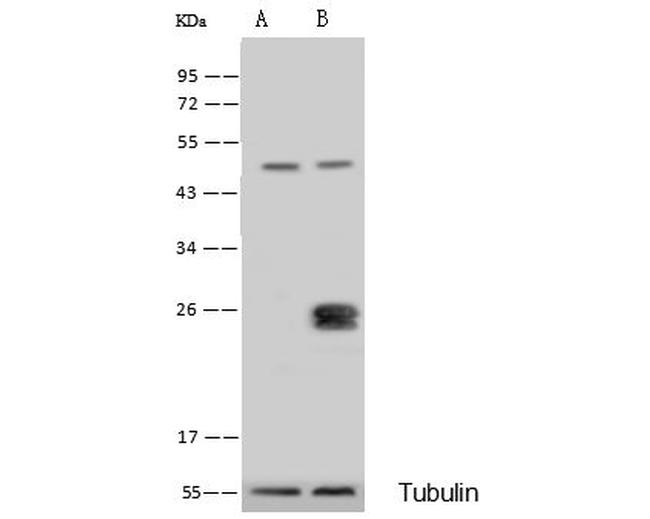 GSTK1 Antibody in Western Blot (WB)