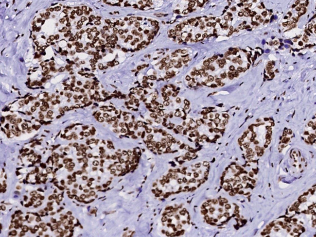 HIST2H2BE Antibody in Immunohistochemistry (Paraffin) (IHC (P))