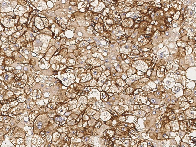 HLA-ABC Antibody in Immunohistochemistry (Paraffin) (IHC (P))