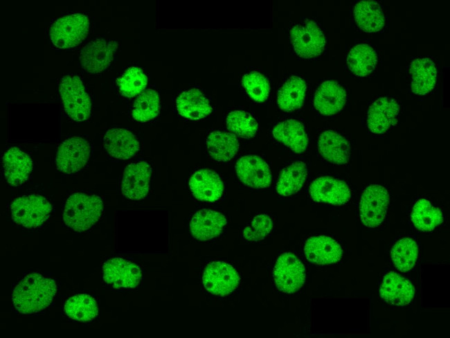 hnRNP M Antibody in Immunocytochemistry (ICC/IF)