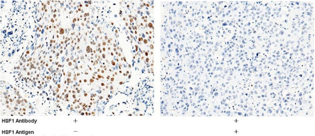 HSF1 Antibody in Immunohistochemistry (Paraffin) (IHC (P))