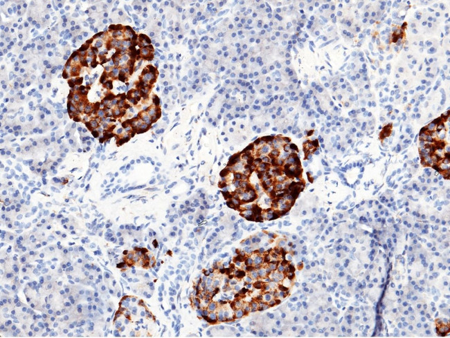 IGFBP7 Antibody in Immunohistochemistry (Paraffin) (IHC (P))