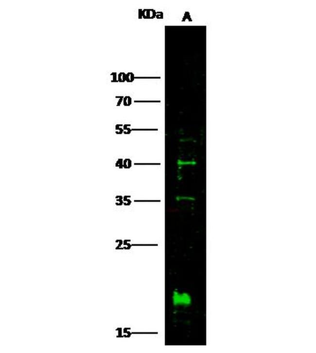 IL10RB Antibody in Western Blot (WB)