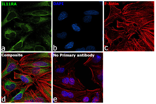 IL11RA Antibody in Immunocytochemistry (ICC/IF)
