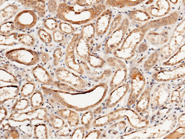 IL1RA Antibody in Immunohistochemistry (Paraffin) (IHC (P))