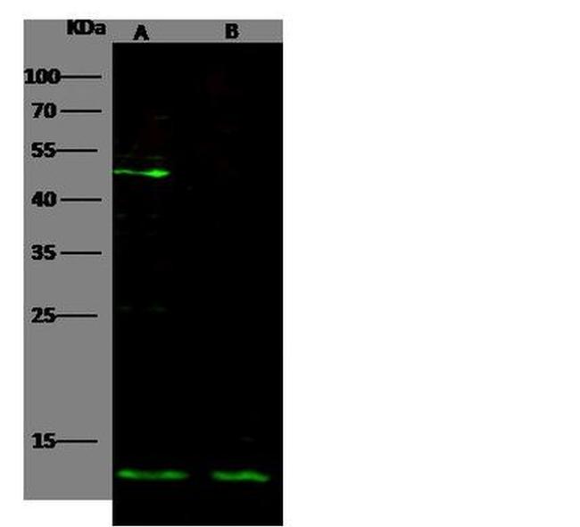 IL-5 Antibody in Western Blot (WB)