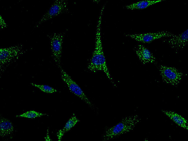 GP130 Antibody in Immunocytochemistry (ICC/IF)