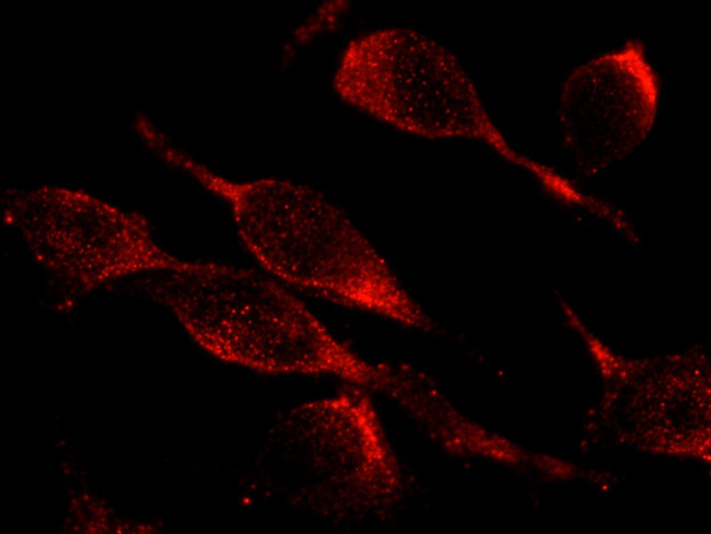 ITGB1 Antibody in Immunocytochemistry (ICC/IF)