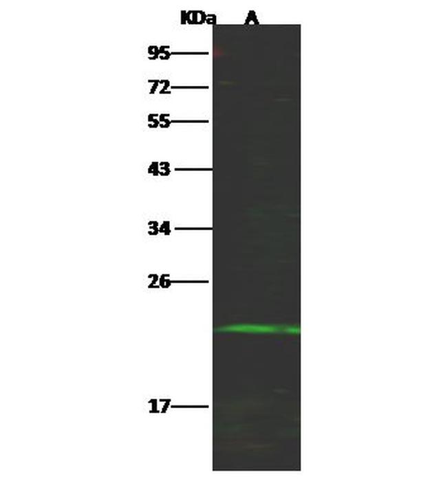NKG2E Antibody in Western Blot (WB)
