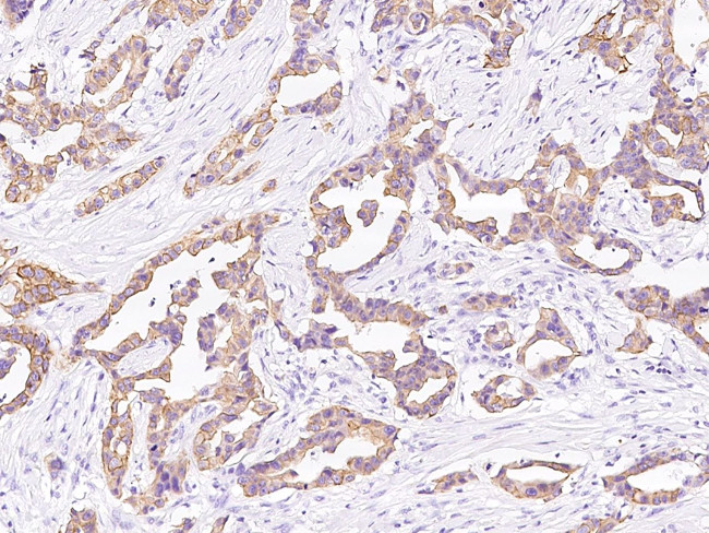 Cytokeratin 6C Antibody in Immunohistochemistry (Paraffin) (IHC (P))