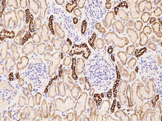 KRT76 Antibody in Immunohistochemistry (Paraffin) (IHC (P))