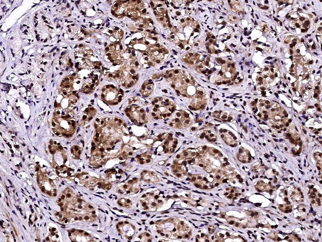 LSM1 Antibody in Immunohistochemistry (Paraffin) (IHC (P))