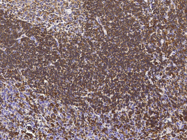 LSP1 Antibody in Immunohistochemistry (Paraffin) (IHC (P))