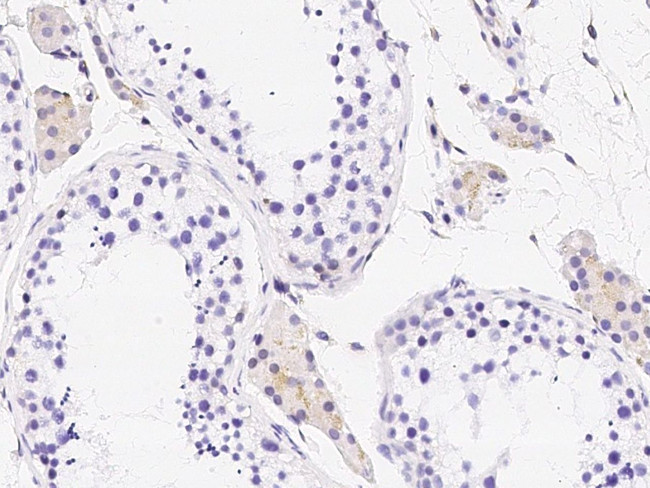 LY6K Antibody in Immunohistochemistry (Paraffin) (IHC (P))