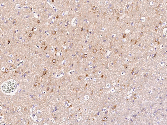 LC3A Antibody in Immunohistochemistry (Paraffin) (IHC (P))