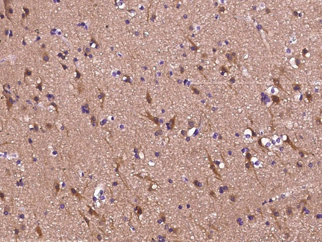 MAPRE3 Antibody in Immunohistochemistry (Paraffin) (IHC (P))
