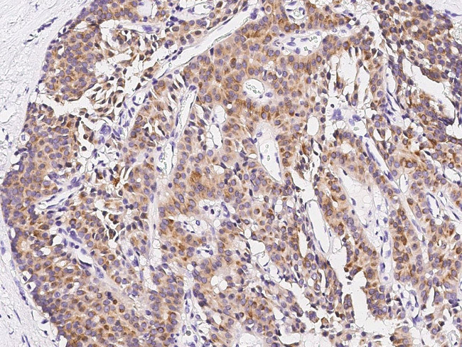 MCL-1 Antibody in Immunohistochemistry (Paraffin) (IHC (P))