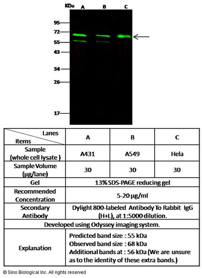 MDMX Antibody in Western Blot (WB)