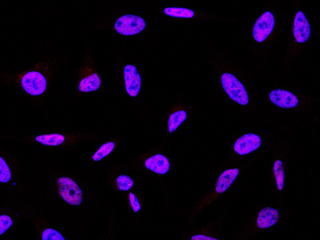 EVI1 Antibody in Immunocytochemistry (ICC/IF)