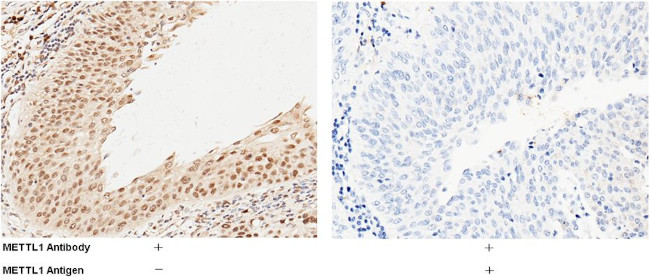 METTL1 Antibody in Immunohistochemistry (Paraffin) (IHC (P))