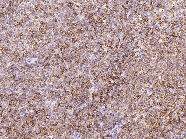 CD10 Antibody in Immunohistochemistry (Paraffin) (IHC (P))