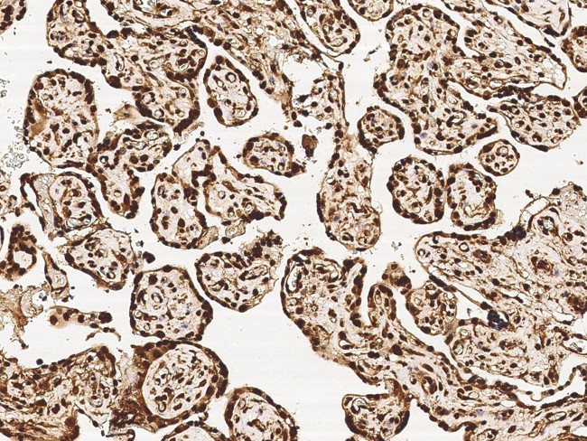 MRTO4 Antibody in Immunohistochemistry (Paraffin) (IHC (P))