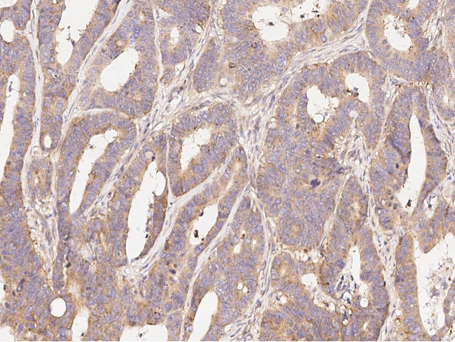 MUC5AC Antibody in Immunohistochemistry (Paraffin) (IHC (P))