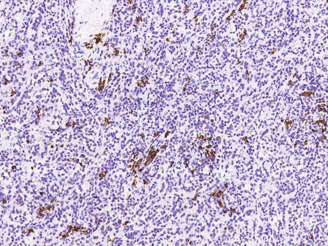 MZB1 Antibody in Immunohistochemistry (Paraffin) (IHC (P))