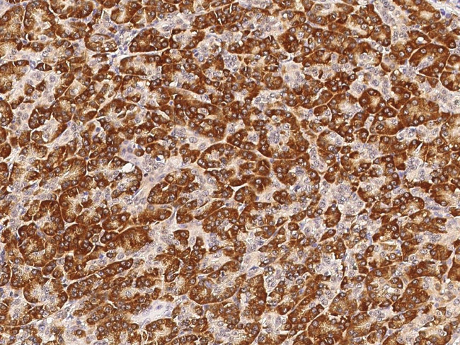 NDUFS3 Antibody in Immunohistochemistry (Paraffin) (IHC (P))