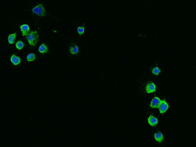 NGFR Antibody in Immunocytochemistry (ICC/IF)
