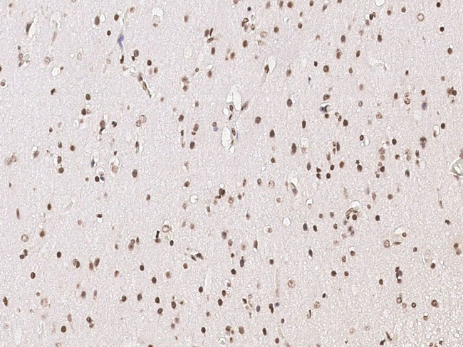 NR1D2 Antibody in Immunohistochemistry (Paraffin) (IHC (P))