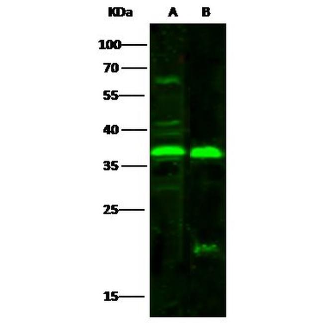 NT5C3A Antibody in Western Blot (WB)