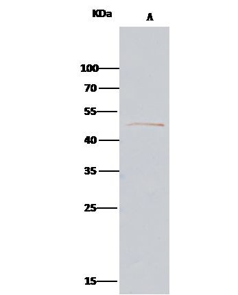 PARVA Antibody in Immunoprecipitation (IP)
