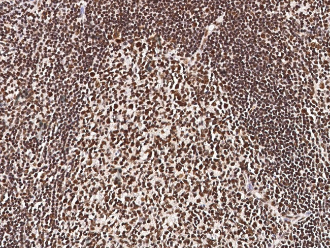 PFDN4 Antibody in Immunohistochemistry (Paraffin) (IHC (P))
