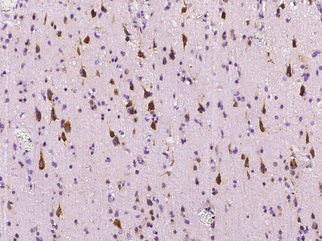 PLBD2 Antibody in Immunohistochemistry (Paraffin) (IHC (P))