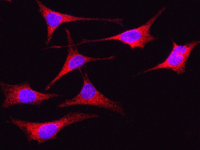 PLK4 Antibody in Immunocytochemistry (ICC/IF)