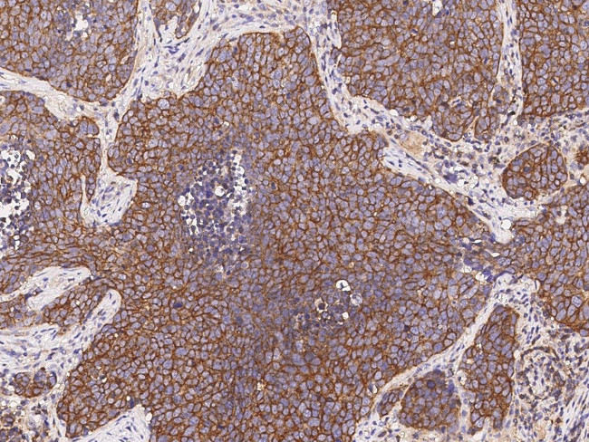 LPPR4 Antibody in Immunohistochemistry (Paraffin) (IHC (P))