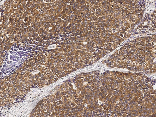 PMM2 Antibody in Immunohistochemistry (Paraffin) (IHC (P))
