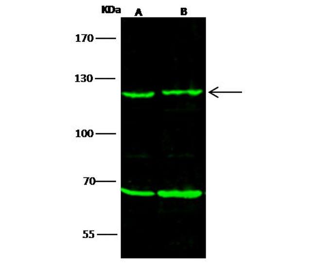 PMS2 Antibody in Western Blot (WB)