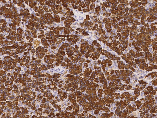 PNLIPRP1 Antibody in Immunohistochemistry (Paraffin) (IHC (P))