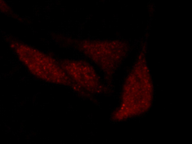 OCT1 (POU2F1) Antibody in Immunocytochemistry (ICC/IF)