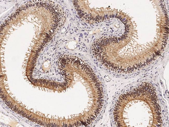 PPIL1 Antibody in Immunohistochemistry (Paraffin) (IHC (P))