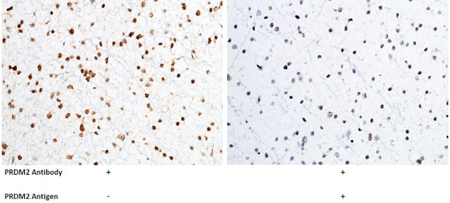 PRDM2 Antibody in Immunohistochemistry (Paraffin) (IHC (P))