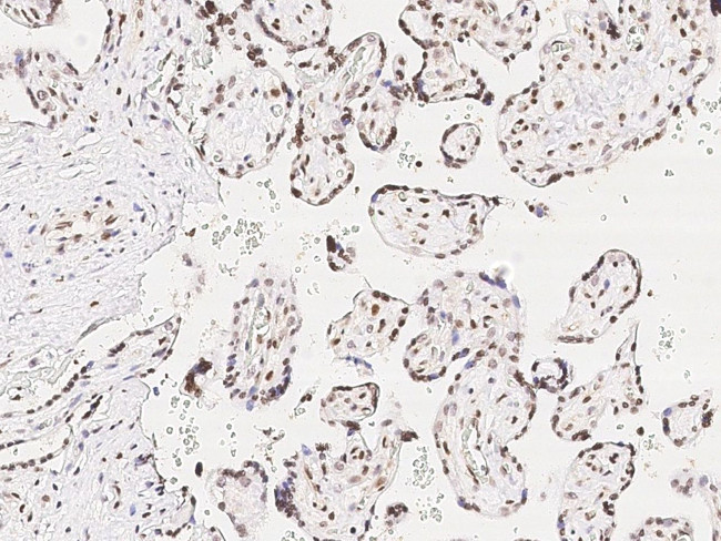 PRDM9 Antibody in Immunohistochemistry (Paraffin) (IHC (P))