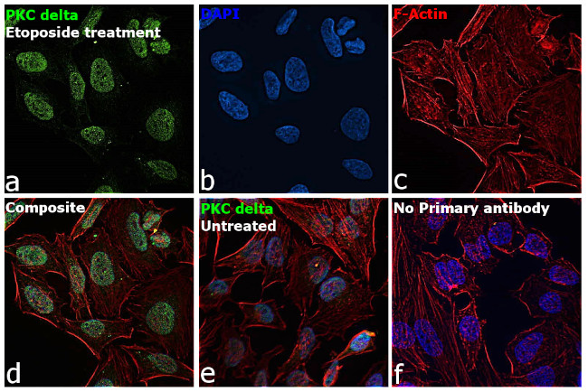 PKC delta Antibody in Immunocytochemistry (ICC/IF)
