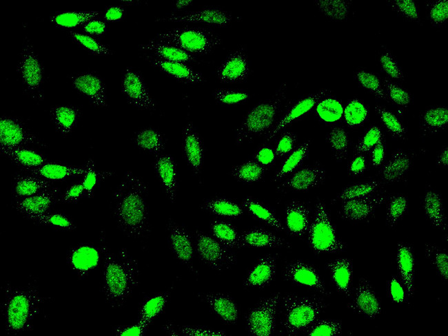 PRMT6 Antibody in Immunocytochemistry (ICC/IF)
