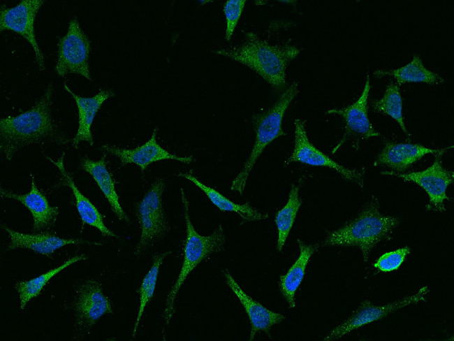 CAP1 Antibody in Immunocytochemistry (ICC/IF)